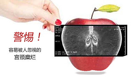 运城宫颈糜烂医院在哪
